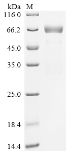 Recombinant Human Calcium/calmodulin-dependent protein kinase type II subunit delta (CAMK2D)