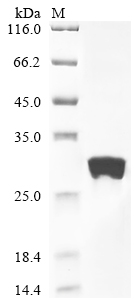 Recombinant Human cytomegalovirus Envelope glycoprotein L (gL)