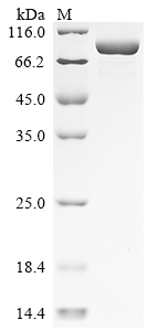 Recombinant Chicken Glyceraldehyde-3-phosphate dehydrogenase (GAPDH), partial, Biotinylated
