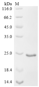 Recombinant Rat Vesicular glutamate transporter 2 (Slc17a6), partial