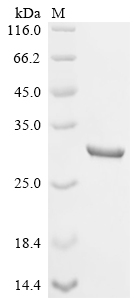 Recombinant Mouse Ribosyldihydronicotinamide dehydrogenase [quinone] (Nqo2)