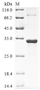 Recombinant Human Protein RRP5 homolog (PDCD11), partial