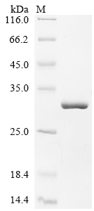 Recombinant Human Ropporin-1A (ROPN1)