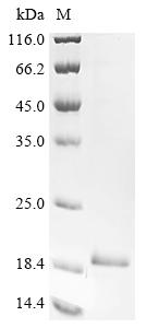 Recombinant Mouse Angiopoietin-like protein 8 (Angptl8) (H40A,Q44A,Q47A)