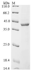 Recombinant Mumps virus Fusion glycoprotein F0 (F), partial