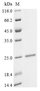Recombinant Human Epididymal-specific lipocalin-6 (LCN6)