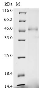Recombinant Mouse Calreticulin (Calr)
