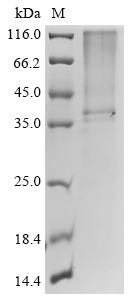 Recombinant Escherichia coli Type 1 fimbrin D-mannose specific adhesin (fimH)