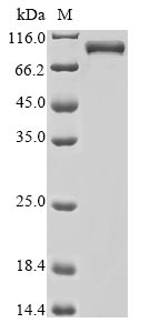 Recombinant Human Mi-2 autoantigen 240 kDa protein, partial