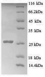 Recombinant Human Myelin transcription factor 1 (MYT1), partial
