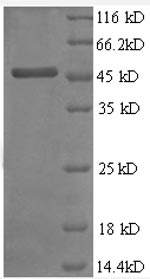 Recombinant Human Metalloproteinase inhibitor 2 (TIMP2), partial