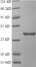 Recombinant Human Beta-adrenergic receptor kinase 1 (GRK2), partial