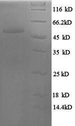 Recombinant Human Serine/arginine-rich splicing factor 9 (SRSF9)