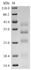 Recombinant Human Cathepsin B (CTSB) (L26V)