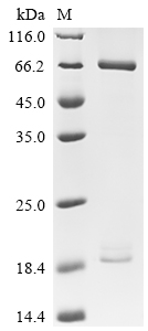 Recombinant Human Proprotein convertase subtilisin/kexin type 9 (PCSK9) (D374Y), partial, Biotinylated
