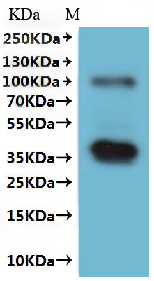 Recombinant Human Membrane protein MLC1 (MLC1)-VLPs