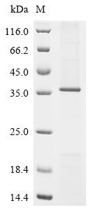 Recombinant Rat Zinc transporter ZIP6 (Slc39a6), partial