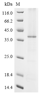Recombinant Macaca fascicularis Zinc transporter ZIP6 isoform X1 (SLC39A6), partial