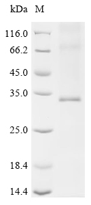 Recombinant Human Aquaporin-7 (AQP7)
