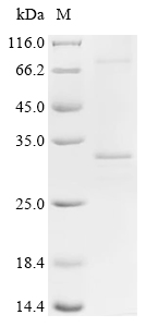 Recombinant Human ATP synthase subunit C lysine N-methyltransferase (ATPSCKMT)