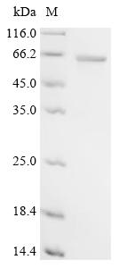 Recombinant Rat RAC-alpha serine/threonine-protein kinase (Akt1)