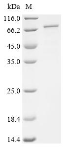 Recombinant Human Polyamine deacetylase HDAC10 (HDAC10)