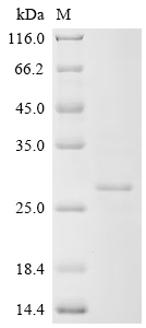 Recombinant Human cytomegalovirus Protein UL16 (UL16), partial