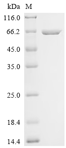 Recombinant Mouse Tyrosine-protein phosphatase non-receptor type 9 (Ptpn9)