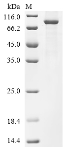 Recombinant Human Kelch repeat and BTB domain-containing protein 7 (KBTBD7)