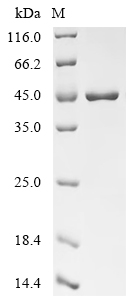 Recombinant Human Histone-lysine N-methyltransferase SETDB1 (SETDB1)