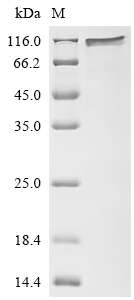 Recombinant Human Disks large homolog 4 (DLG4)
