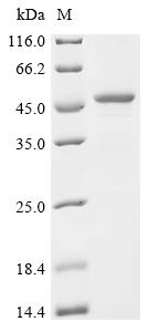 Recombinant Human Sharpin (SHARPIN)