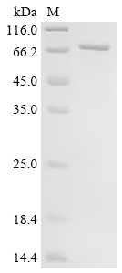 Recombinant Human T-box transcription factor TBX21 (TBX21)