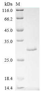 Recombinant Cat Ferritin light chain (FTL)
