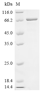 Recombinant Human Forkhead box protein C1 (FOXC1)