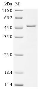 Recombinant JC polyomavirus Major capsid protein VP1