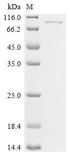 Recombinant Mouse Beta-adrenergic receptor kinase 2 (Adrbk2)