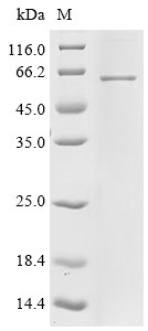 Recombinant Human Matrix metalloproteinase-25 (MMP25)