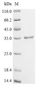 Recombinant Human Cell division cycle and apoptosis regulator protein 1 (CCAR1), partial