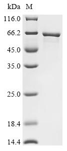 Recombinant Human E3 ubiquitin-protein ligase makorin-1 (MKRN1)