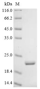 Recombinant Human Calponin-2 (CNN2) (E39A,D49A,K52A,K55A,D56A,R77A,H83A), partial