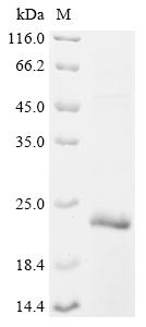 Recombinant Human Complement receptor type 1 (CR1), partial