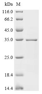 Recombinant Human Splicing factor 3B subunit 1 (SF3B1) (S488F), partial