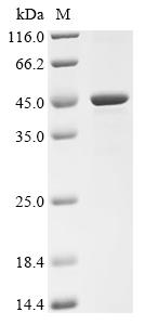 Recombinant Human ADP-ribosylation factor GTPase-activating protein 1 (ARFGAP1)