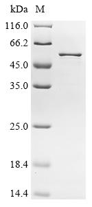 Recombinant Human Nuclear receptor corepressor 1 (NCOR1), partial