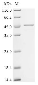 Recombinant Anisakis simplex Tropomyosin