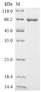 Recombinant Mouse N-myc-interactor (Nmi)