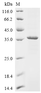 Recombinant Rat Lutropin-choriogonadotropic hormone receptor (Lhcgr), partial