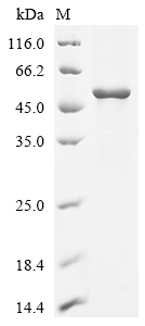 Recombinant Tick-borne encephalitis virus Far Eastern subtype Genome polyprotein, partial
