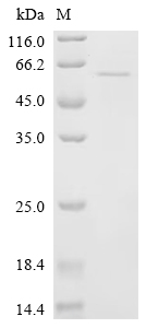 Recombinant Tick-borne encephalitis virus Far Eastern subtype Genome polyprotein, partial
